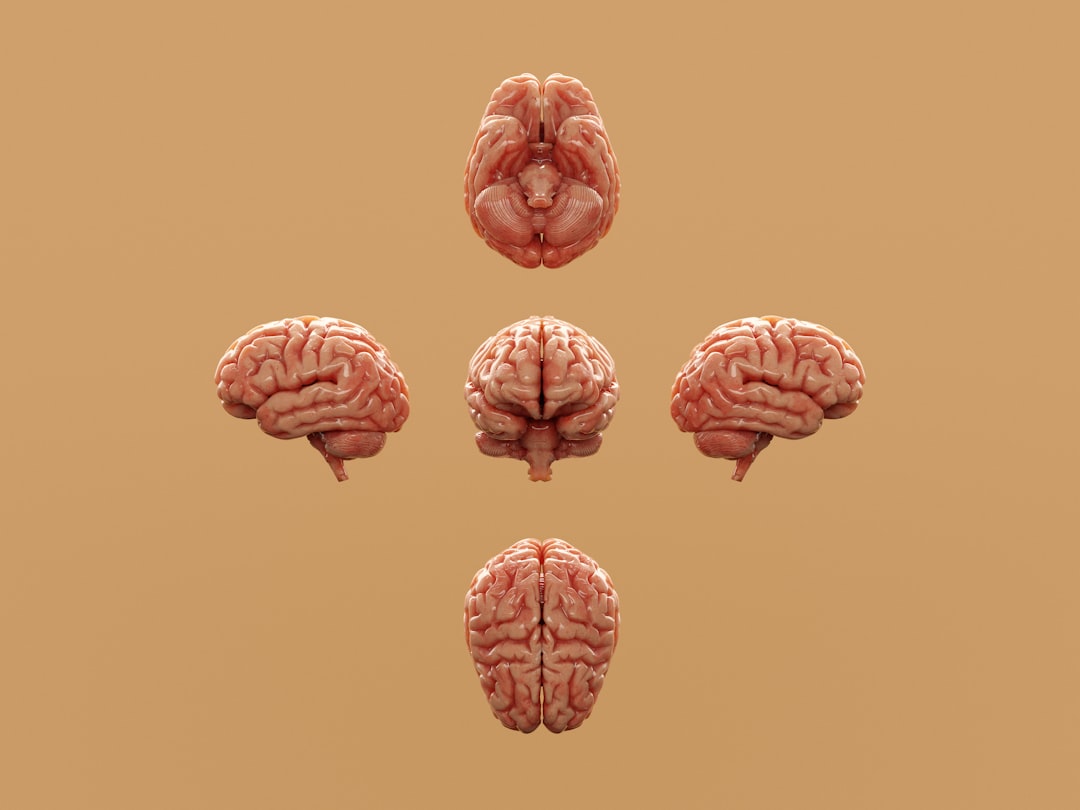 Various perspectives of a human brain are displayed.